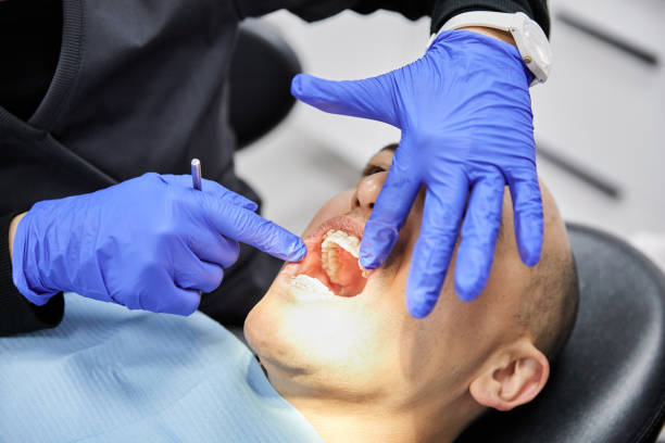 Best Knocked-Out Tooth Emergency  in Coshocton, OH